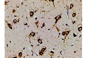 ABIN6267452 at 1/200 staining human brain tissue sections by IHC-P.