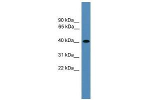 AIMP2 antibody used at 0. (AIMP2 anticorps  (Middle Region))