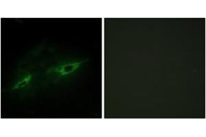 Immunofluorescence analysis of NIH-3T3 cells, using CDH22 Antibody. (CDH22 anticorps  (AA 111-160))