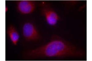 Image no. 3 for anti-Eukaryotic Translation Initiation Factor 2-alpha Kinase 2 (EIF2AK2) (Thr446) antibody (ABIN197544) (EIF2AK2 anticorps  (Thr446))