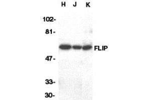 Western Blotting (WB) image for anti-CASP8 and FADD-Like Apoptosis Regulator (CFLAR) (C-Term) antibody (ABIN1030398) (FLIP anticorps  (C-Term))