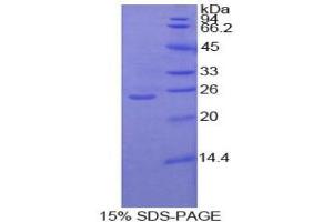 SDS-PAGE analysis of Human Protein Kinase C zeta Protein. (PKC zeta Protéine)
