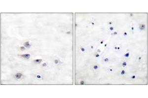 Immunohistochemistry analysis of paraffin-embedded human brain, using Shc (Phospho-Tyr427) Antibody. (SHC1 anticorps  (pTyr427))