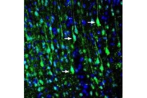 Expression of LRRTM1 in rat cortex - Immunohistochemical staining of perfusion-fixed frozen rat brain sections with Anti-LRRTM1 (extracellular) Antibody (ABIN7043302, ABIN7044730 and ABIN7044731), (1:200), followed by goat-anti-rabbit-AlexaFluor-488.