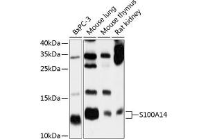 Western blot analysis of extracts of various cell lines, using S100 antibody (ABIN6128693, ABIN6147339, ABIN6147340 and ABIN6214636) at 1:1000 dilution. (S100A14 anticorps  (AA 1-104))