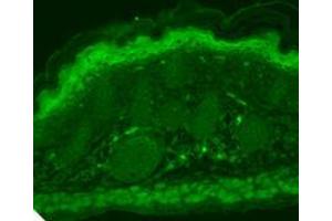 TrpV3 (S15 4), Human Hippocampus.