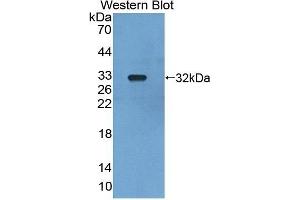 Detection of Recombinant LRDD, Mouse using Polyclonal Antibody to Leucine Rich Repeats And Death Domain Containing Protein (LRDD) (Leucine Rich Repeats And Death Domain Containing Protein (AA 666-915) anticorps)
