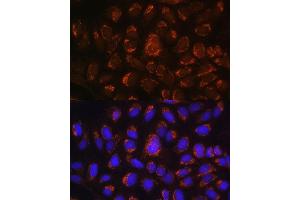 Immunofluorescence analysis of U-2 OS cells using  antibody (ABIN6129884, ABIN6137152, ABIN6137153 and ABIN6214229) at dilution of 1:100.