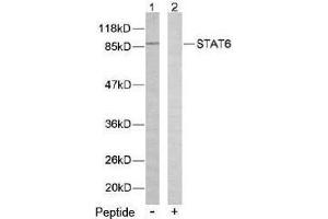 Image no. 2 for anti-Signal Transducer and Activator of Transcription 6, Interleukin-4 Induced (STAT6) (Thr645) antibody (ABIN197187) (STAT6 anticorps  (Thr645))