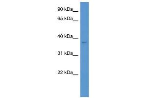 WB Suggested Anti-Cacng3 Antibody Titration: 0. (CACNG3 anticorps  (C-Term))