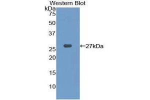 Western Blotting (WB) image for anti-phosphofructokinase, Platelet (PFKP) (AA 553-753) antibody (ABIN1860192) (PFKP anticorps  (AA 553-753))