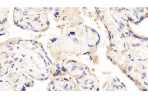 Detection of LEP in Human Placenta Tissue using Polyclonal Antibody to Leptin (LEP)