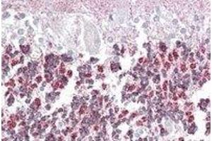 Immunohistochemistry (IHC) image for anti-Epilepsy, Progressive Myoclonus Type 2A, Lafora Disease (Laforin) (EPM2A) (Internal Region) antibody (ABIN2466629) (EPM2A anticorps  (Internal Region))