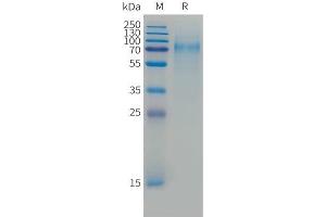 Cynomolgus CD30 Protein, His Tag on SDS-PAGE under reducing condition.