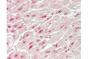 Human Heart: Formalin-Fixed, Paraffin-Embedded (FFPE).