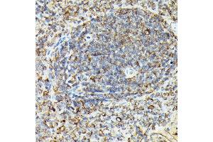 Immunohistochemistry of paraffin-embedded rat spleen using Phospho-VASP-S239 Rabbit pAb (ABIN3019748, ABIN3019749, ABIN3019750, ABIN1682137 and ABIN1682138) at dilution of 1:50 (40x lens).