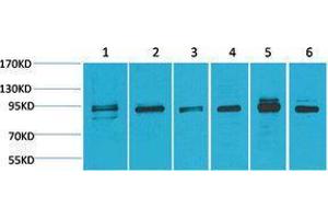 Western Blotting (WB) image for anti-Mitogen-Activated Protein Kinase 7 (MAPK7) antibody (ABIN3181518)
