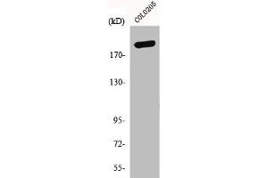 Western Blot analysis of COLO205 cells using GCP6 Polyclonal Antibody (GCP6 anticorps  (Internal Region))