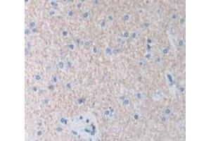 Used in DAB staining on fromalin fixed paraffin- embedded Kidney tissue (AIP anticorps  (AA 63-296))