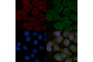 ABIN6257077 and ABIN6275765 staining Hela cells(30 min of UV treatment) by IF/ICC. (FGFRL1 anticorps  (Internal Region))