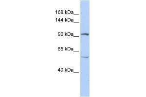 WB Suggested Anti-LRRC66 Antibody Titration:  0. (LRRC66 anticorps  (Middle Region))