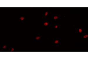 ABIN6266854 staining K-562 cells by IF/ICC. (PRKDC anticorps  (Internal Region))