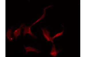 ABIN6275251 staining Hela by IF/ICC.