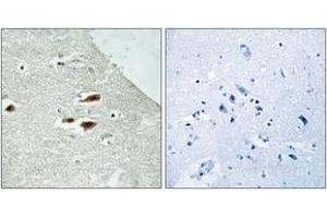 Immunohistochemistry analysis of paraffin-embedded human brain, using Period Circadian Protein 2 (Phospho-Ser662) Antibody.