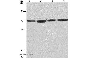Western blot analysis of HUVEC, NIH/3T3, Hela and 293T cell, using KLF11 Polyclonal Antibody at dilution of 1:475 (KLF11 anticorps)