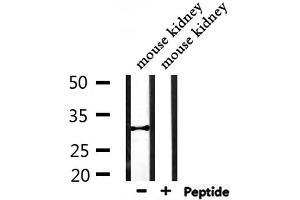 Western blot analysis of extracts from mouse kidney, using CBR1 Antibody. (CBR1 anticorps  (C-Term))