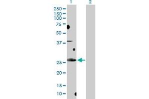 Western Blot analysis of BCL7B expression in transfected 293T cell line by BCL7B MaxPab polyclonal antibody. (BCL7B anticorps  (AA 1-202))