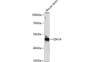 Western blot analysis of extracts of mouse testis, using CDK14 antibody (ABIN7266579) at 1:1000 dilution. (CDK14 anticorps  (AA 312-451))