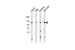 All lanes : Anti-LILRB1 Antibody (Center) at 1:500-1:2000 dilution Lane 1: Daudi whole cell lysate Lane 2: Raji whole cell lysate Lane 3: Ramos whole cell lysate Lane 4: SH-SY5Y whole cell lysate Lysates/proteins at 20 μg per lane. (LILRB1 anticorps  (AA 345-374))