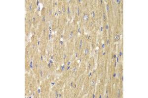 Immunohistochemistry (IHC) image for anti-Neutrophil Cytosolic Factor 2 (NCF2) (AA 227-526) antibody (ABIN3021641)