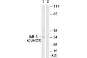 Western blot analysis of extracts from HeLa cells treated with TNF-a 20ng/ml 5', using IkappaB-beta (Phospho-Ser23) Antibody. (NFKBIB anticorps  (pSer23))