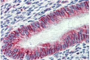 Uterus, Human: Formalin-Fixed, Paraffin-Embedded (FFPE) (PHACTR1 anticorps  (AA 468-517))