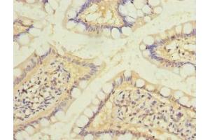 Immunohistochemistry of paraffin-embedded human small intestine tissue using ABIN7167369 at dilution of 1:100 (RAB6B anticorps  (AA 2-208))