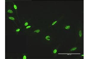 Immunofluorescence of purified MaxPab antibody to ZNF530 on HeLa cell.