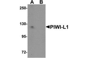 Western blot analysis of PIWI-L1 in HepG2 cell lysate with PIWI-L1 antibody at 1 μg/ml in (A) the absence and (B) the presence of blocking peptide. (PIWIL1 anticorps  (N-Term))