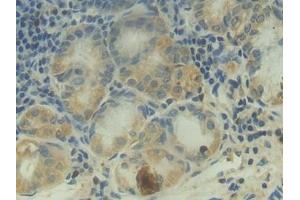 Detection of C2 in Human Stomach Tissue using Polyclonal Antibody to Complement Component 2 (C2)