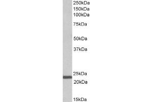 ABIN2563394 (1µg/ml) staining of Human Bone Marrow lysate (35µg protein in RIPA buffer). (IL-15 anticorps  (AA 70-82))
