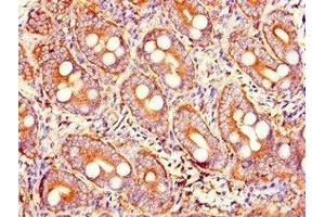 Immunohistochemistry of paraffin-embedded human small intestine tissue using ABIN7173598 at dilution of 1:100 (PRSS2 anticorps  (AA 24-247))