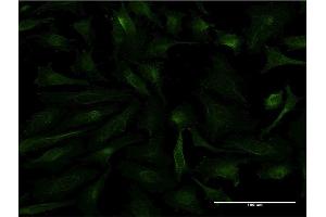 Immunofluorescence of monoclonal antibody to FTL on HeLa cell. (FTL anticorps)