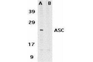 Western Blotting (WB) image for anti-PYD and CARD Domain Containing (PYCARD) (AA 182-195) antibody (ABIN2476855)