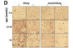 Immunohistochemistry using ABIN285516 visualizes reduced HBsAg expression in female Abcb4−/−/HBsAg+/− mice. (HBSAg anticorps)