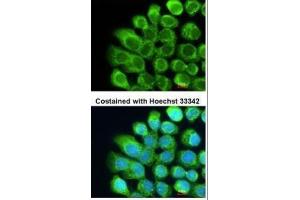ICC/IF Image Immunofluorescence analysis of methanol-fixed A431, using Complement C2, antibody at 1:200 dilution. (Complement C2 anticorps)