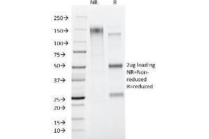 SDS-PAGE Analysis Purified CD45RA Mouse Monoclonal Antibody (PTPRC/818).