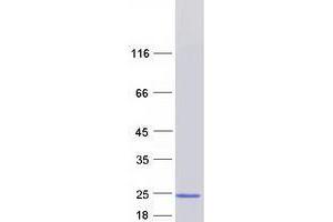 Validation with Western Blot