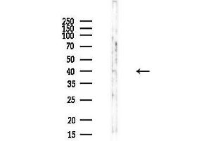 anti-Mitochondrial Ribosomal Protein S9 (MRPS9) (Internal Region) antibody