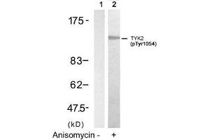 Western blot analysis of extracts from HT29 cells untreated(lane 1) or treated with Anisomycin(lane 2) using TYK2(Phospho-Tyr1054) Antibody. (TYK2 anticorps  (pTyr1054))